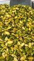 تصویر مغز کره گیری