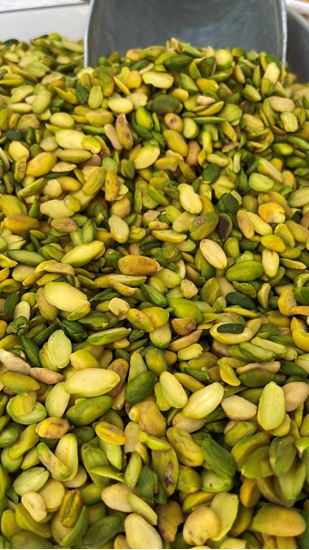تصویر مغز کره گیری